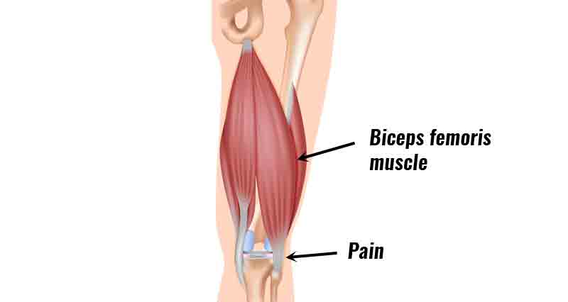 biceps femoris injury recovery time